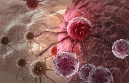 A daganatos megbetegedések lehetséges első jelei